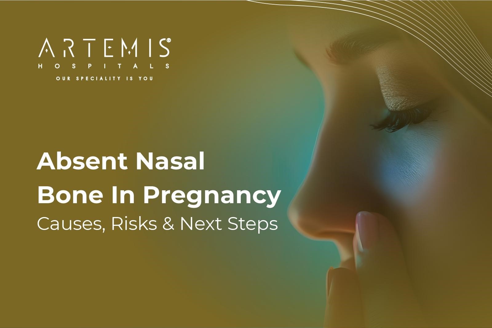 Absent Nasal Bone Newborn