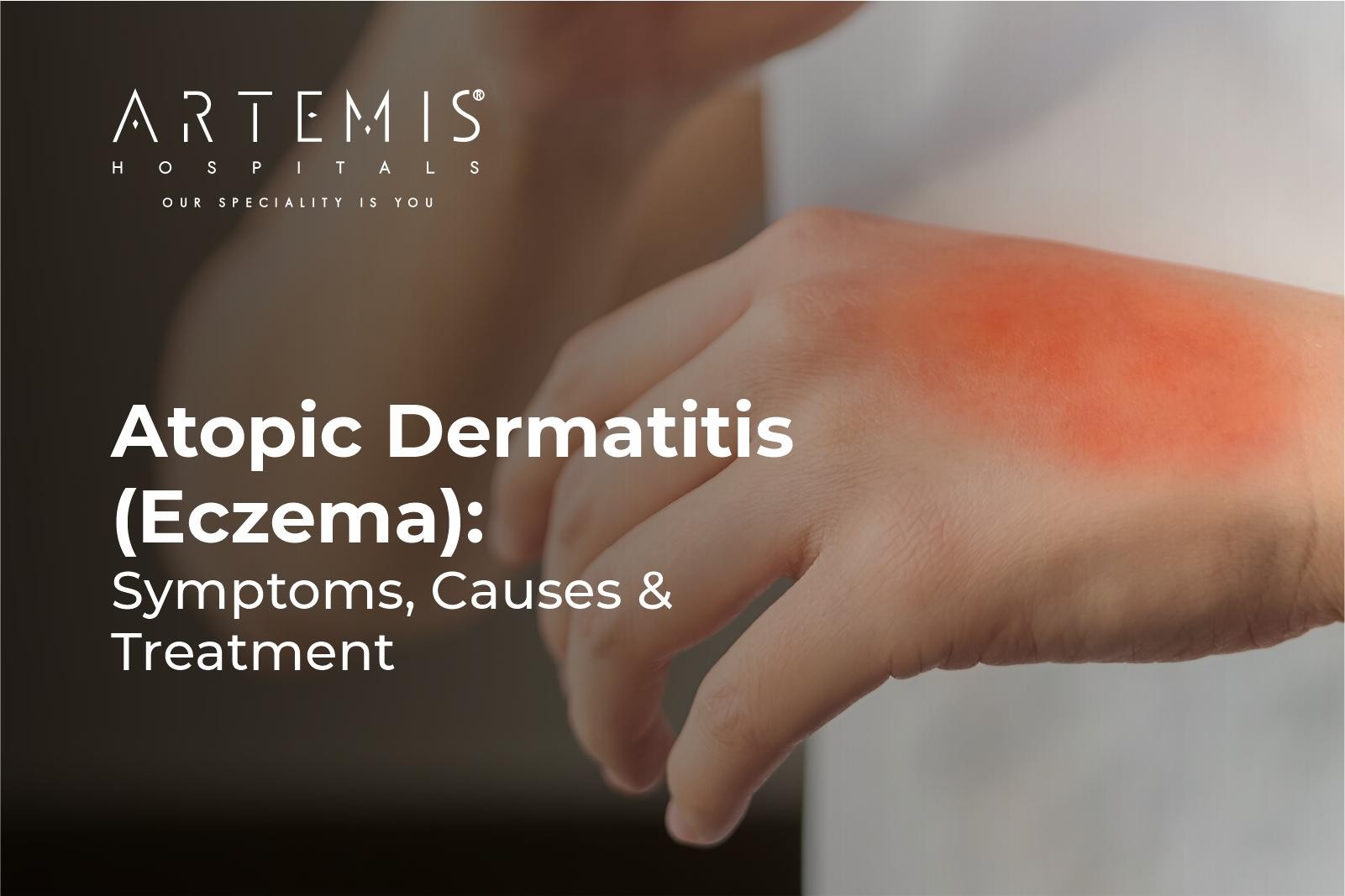 Atopic Dermatitis Eczema