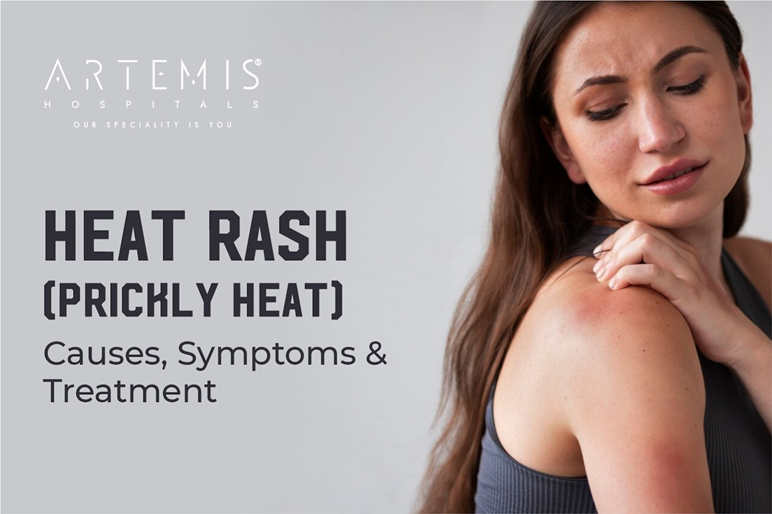Heat Rash Symptoms