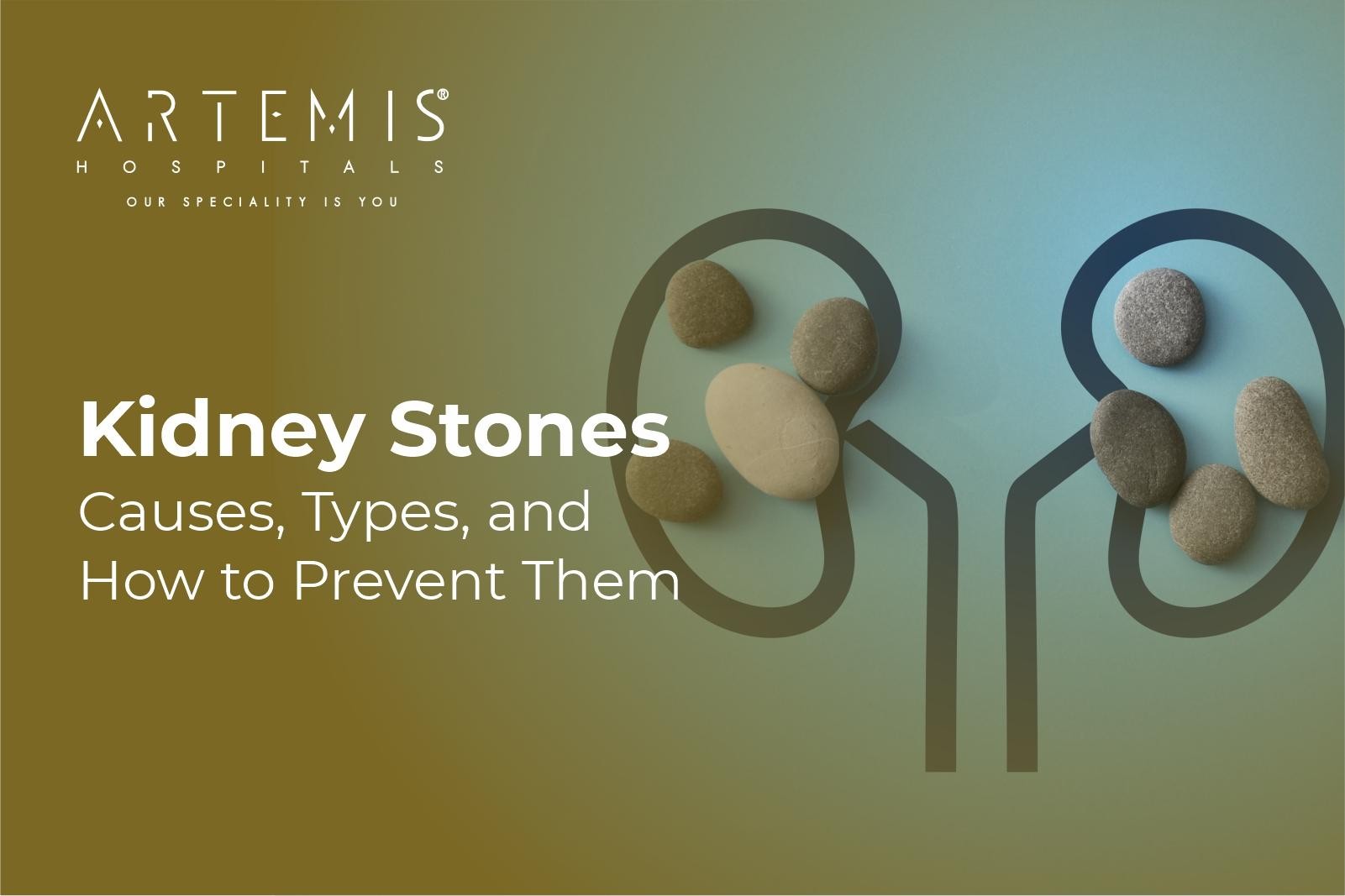 Kidney Stones symptoms
