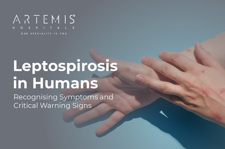 Leptospirosis Symptoms