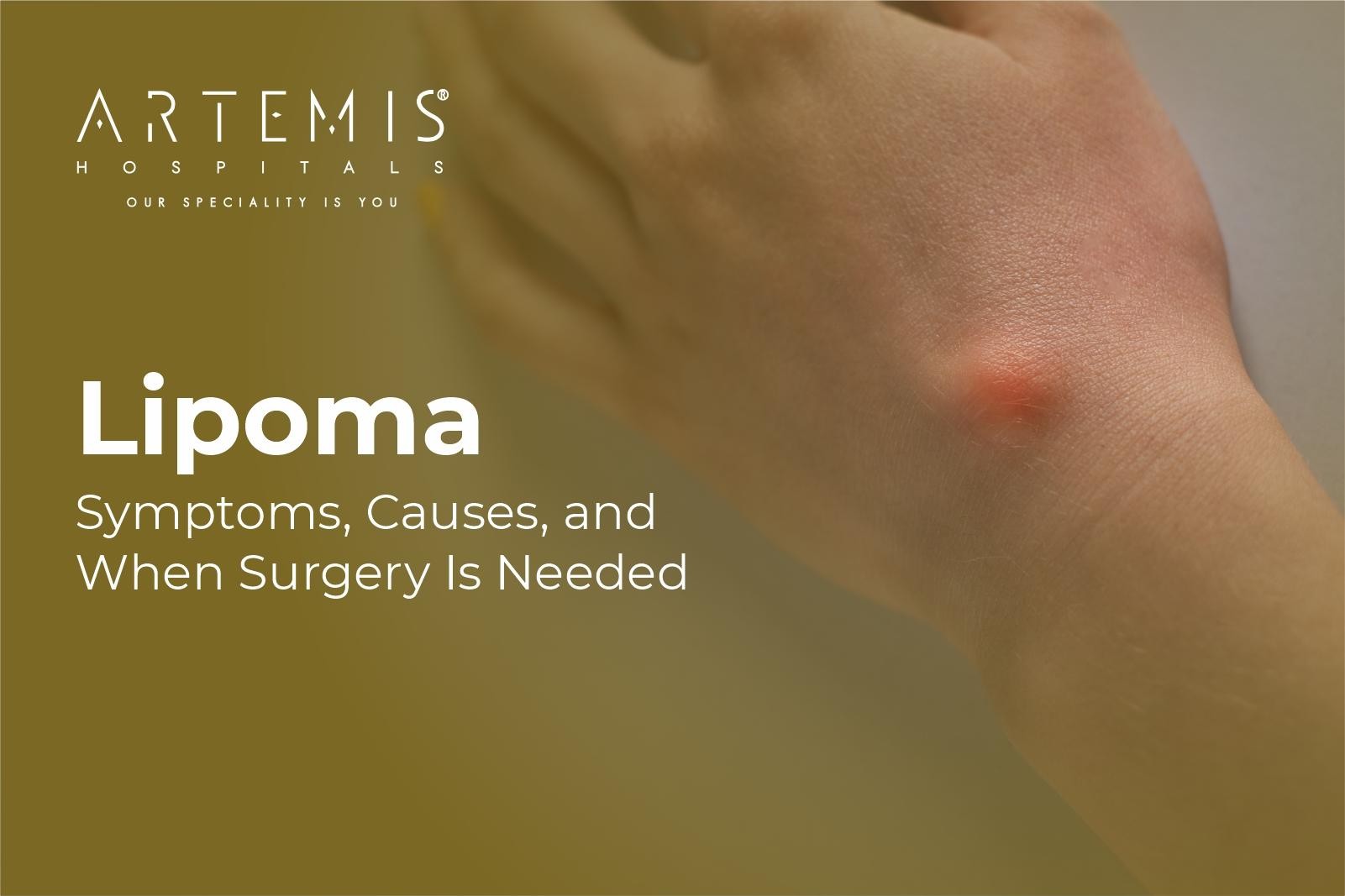 Lipoma Symptoms