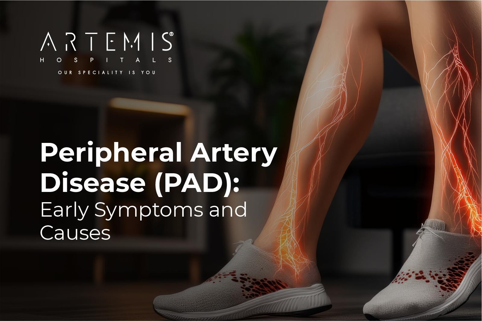Peripheral Artery Disease