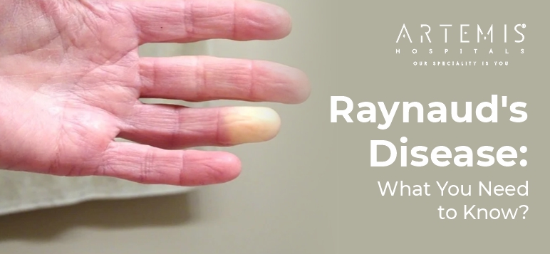 Raynaud