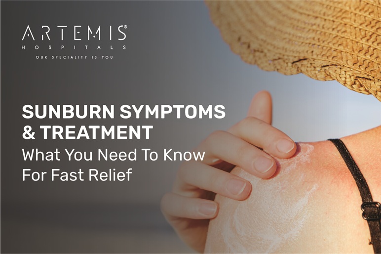 Sunburn Treatment