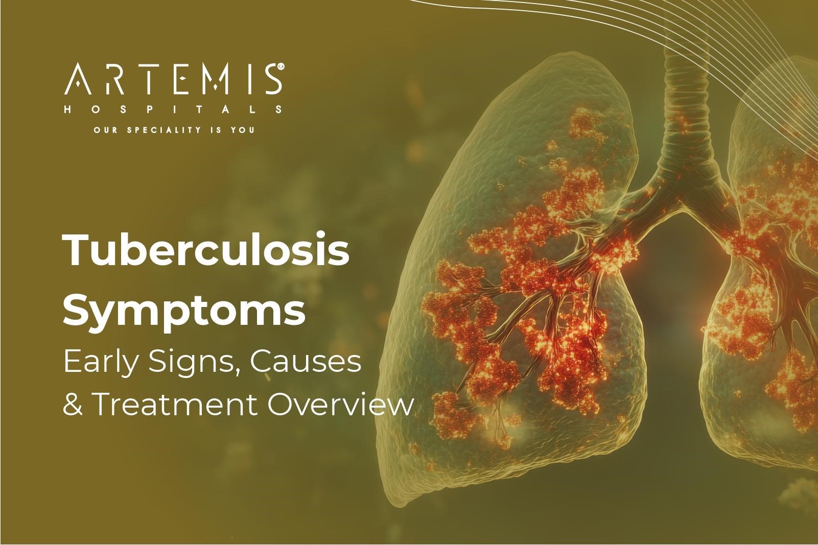 Tuberculosis Symptoms