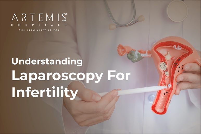 Laparoscopy For Infertility