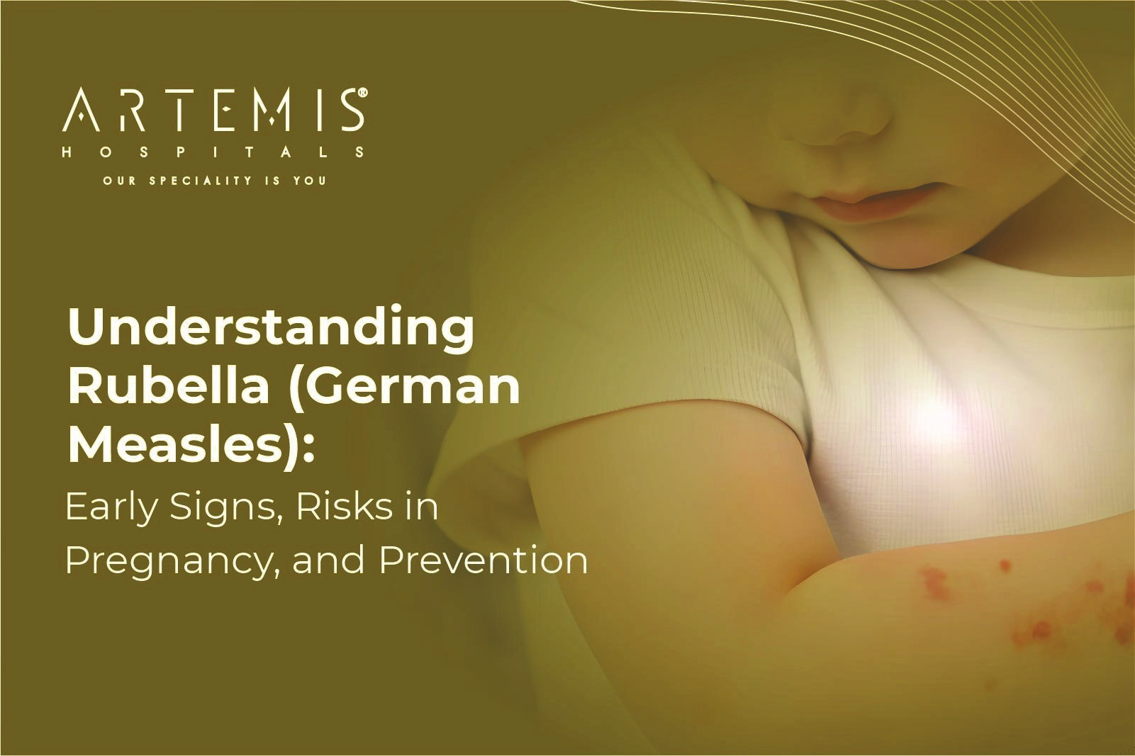 Rubella Symptoms